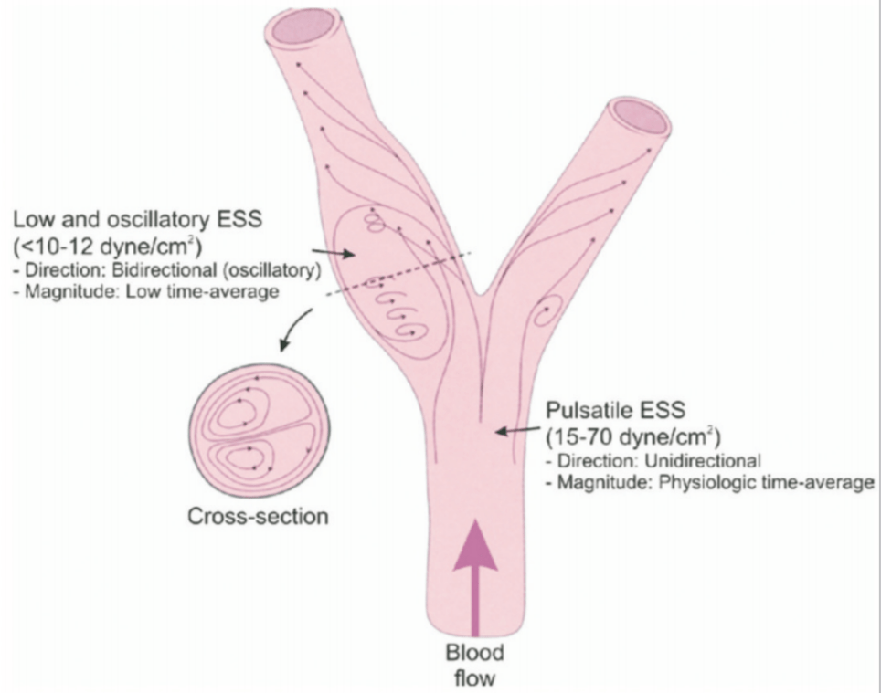 The cause of atherosclerosis is unknown… or is&nbsp;it?